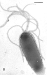 Bakteri Vibrio di Tambak